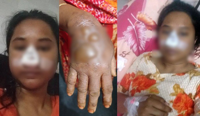 হামলায় আহত মোঃ নুরুল ইসলামের স্ত্রী এবং কন্যা । ছবি : সংগ্রহীত 